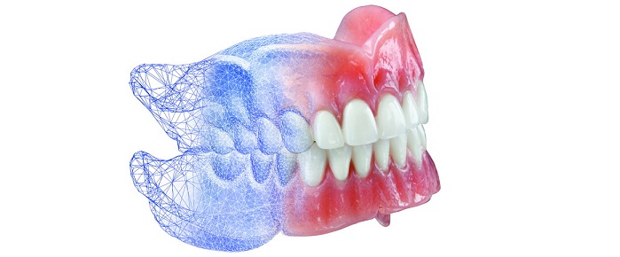 Tout savoir sur les prothèses dentaires conjointes
